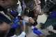 A Palestinian child wounded in the Israeli bombardment of th