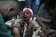 A Palestinian child wounded by the Israeli bombardment of th