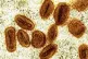 This colourized electron microscope image provided by the Na