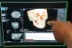 A clinical radiologist views results from a scan in the Inte