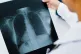 Radiology doctor examining a chest X-ray 